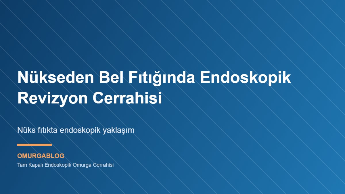 Nüks bel fıtığında endoskopik revizyon cerrahisinin anatomik görseli
