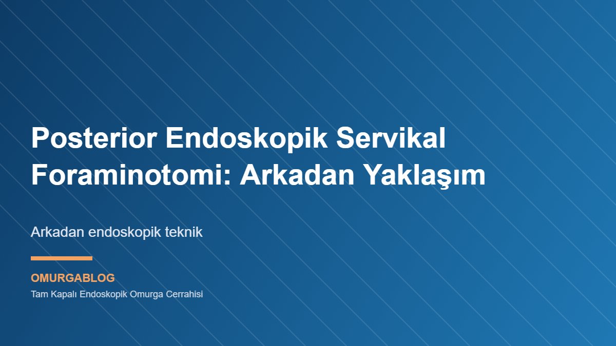 Posterior endoskopik servikal foraminotomi tekniğinin şematik görseli